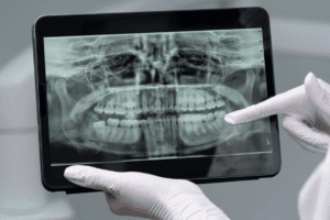Radiografia Panorâmica