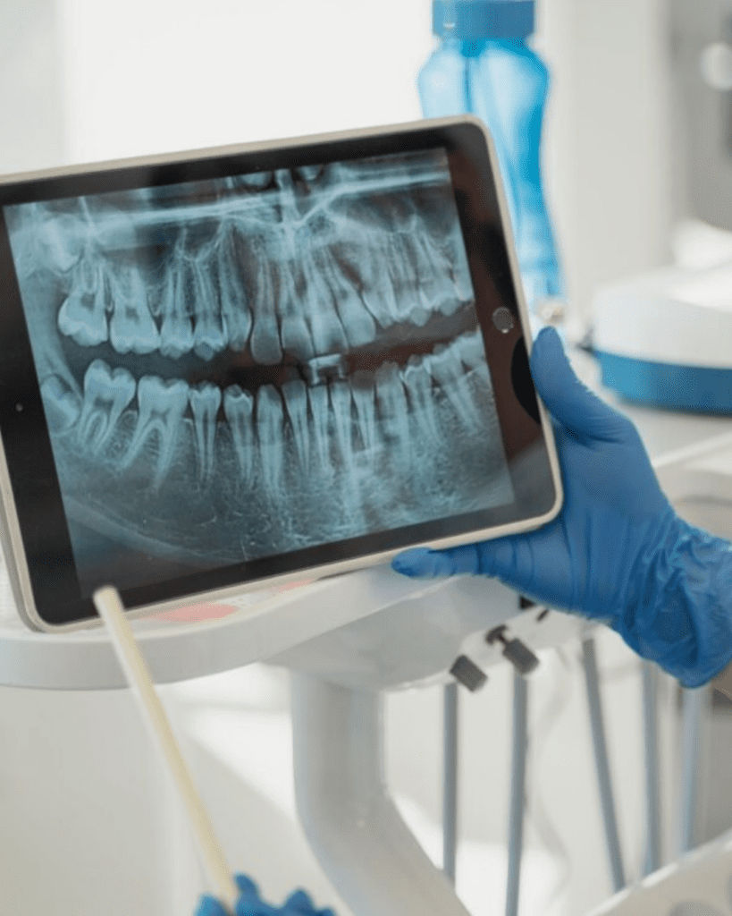Radiografia Panorâmica